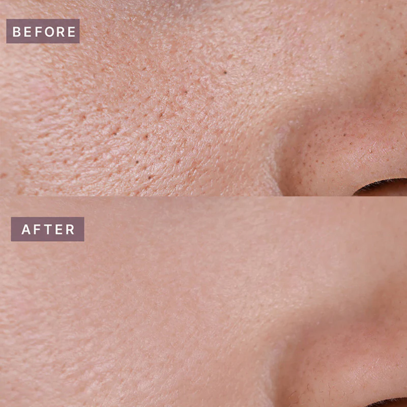 Heveblue Pot Pore tightening Podo Ampoule