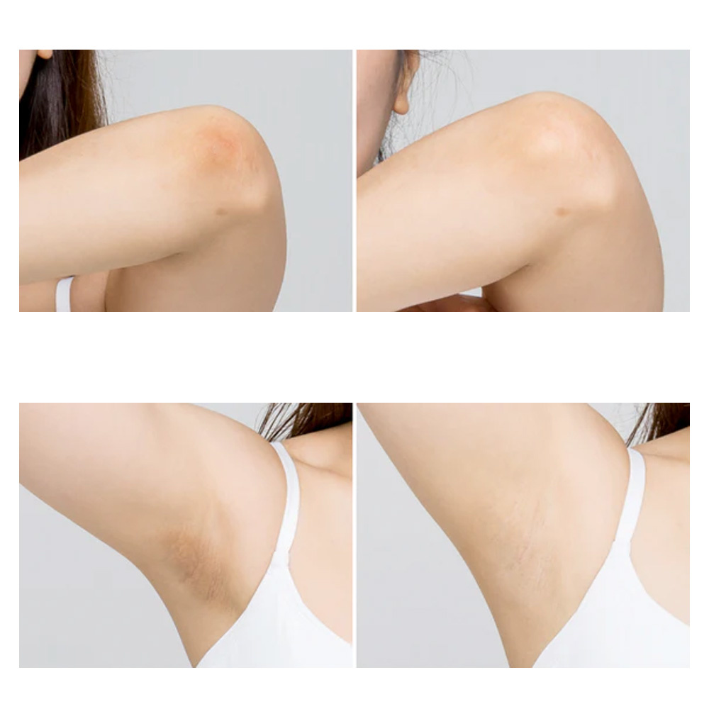 Celimax One Step Body Brightening Pad